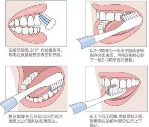 巴氏刷牙法是什么，什么叫巴氏刷牙法